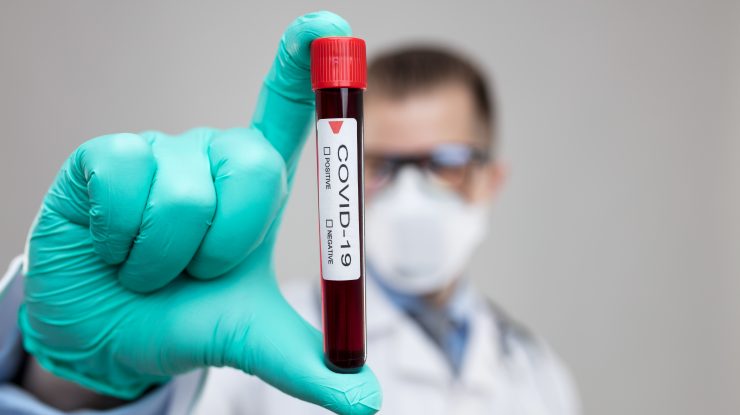 România are peste 16.000 de cazuri de Covid-19