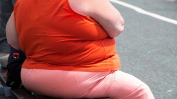 Cu cât mai obez, cu atât mai predispus la forme grave de Covid-19. Medicii spun că kilogramele în plus slăbesc sistemul imunitar