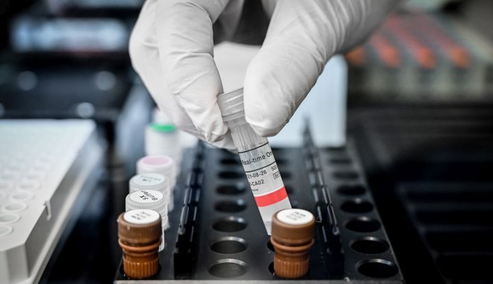 Testele chinezești pentru depistarea Covid-19, returnate pentru a doua oară de spanioli