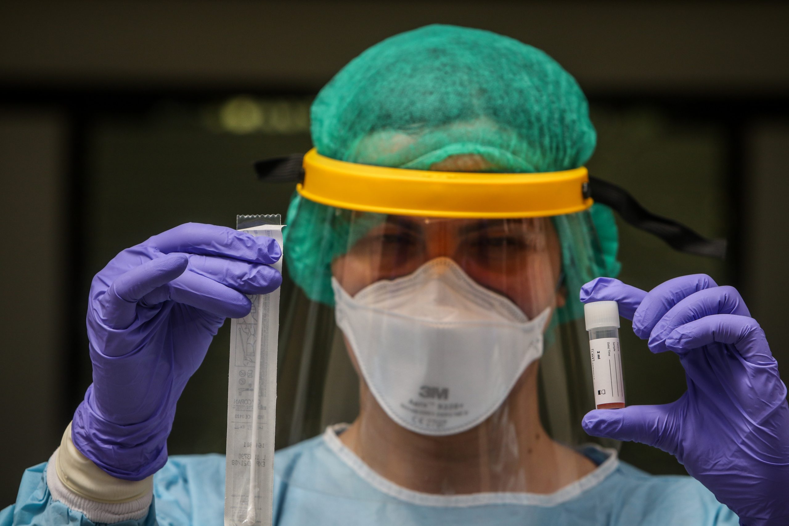 Peste 5 milioane de cazuri de Covid-19 în întreaga lume. Câte persoane au fost vindecate și externate