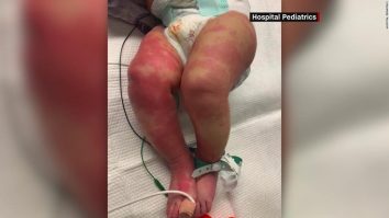 Coronavirusul și boala Kawasaki: un copil de 9 ani a murit la Marsilia