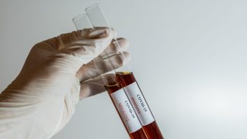 32.955 de morţi în Italia, marți seară. 96% dintre decesele de Coronavirus prezentau multiple comorbidități