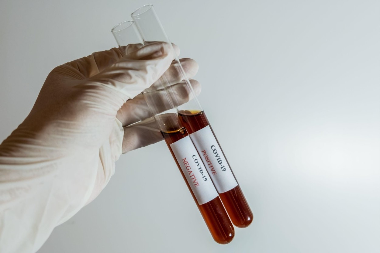 32.955 de morţi în Italia, marți seară. 96% dintre decesele de Coronavirus prezentau multiple comorbidități