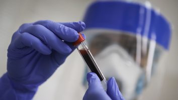 47 de români care lucrează la abatorul din Dissen au fost infectați cu COVID-19. Cum îi ajută compania