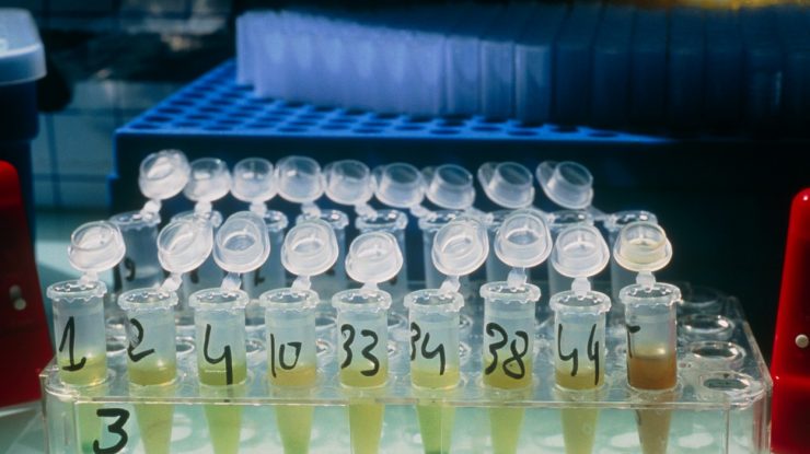 Toţi pacienţii de la ”Matei Balş” vor face teste serologice tip Elisa