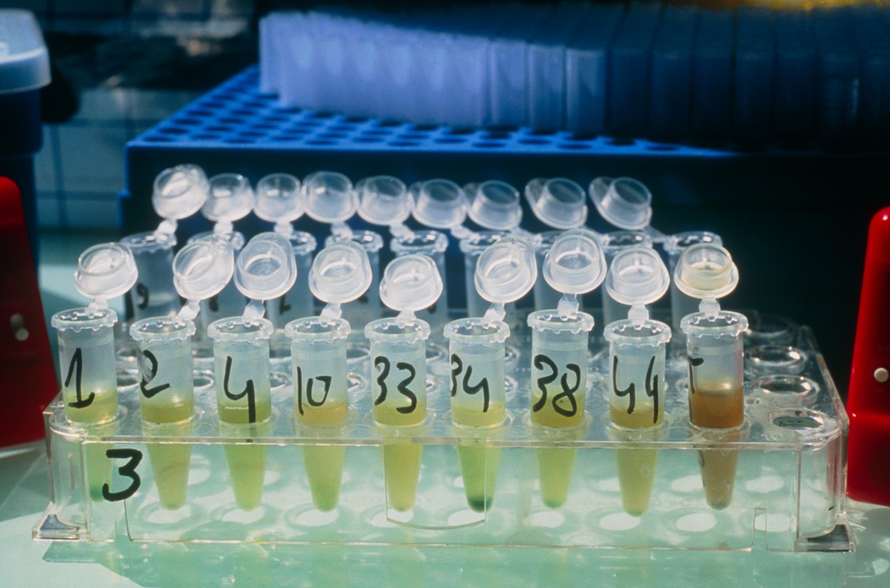 Toţi pacienţii de la ”Matei Balş” vor face teste serologice tip Elisa