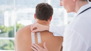 Simptome Covid-19 la care nu te-ai gândit. Virusul poate afecta și pielea, spun dermatologii