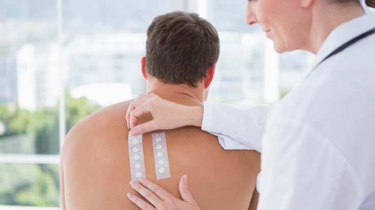 Simptome Covid-19 la care nu te-ai gândit. Virusul poate afecta și pielea, spun dermatologii