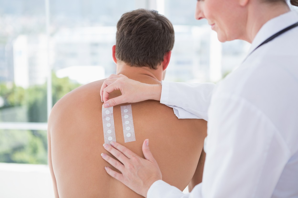 Simptome Covid-19 la care nu te-ai gândit. Virusul poate afecta și pielea, spun dermatologii