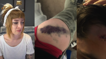 Vloggerița Bianca Adam (Tequila) a fost bătută pe strada cu o rangă. Poliția Ilfov a deschis un dosar penal