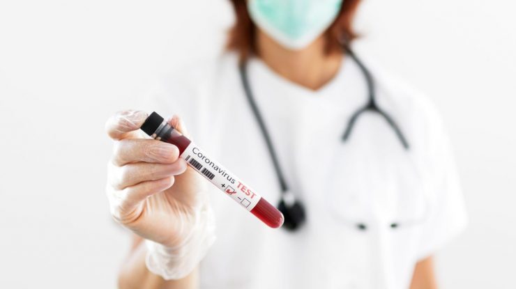 LIVE UPDATE 20 iunie: Numărul cazurilor noi se menține peste pragul de 300. Bilanțul deceselor a urcat la 1500