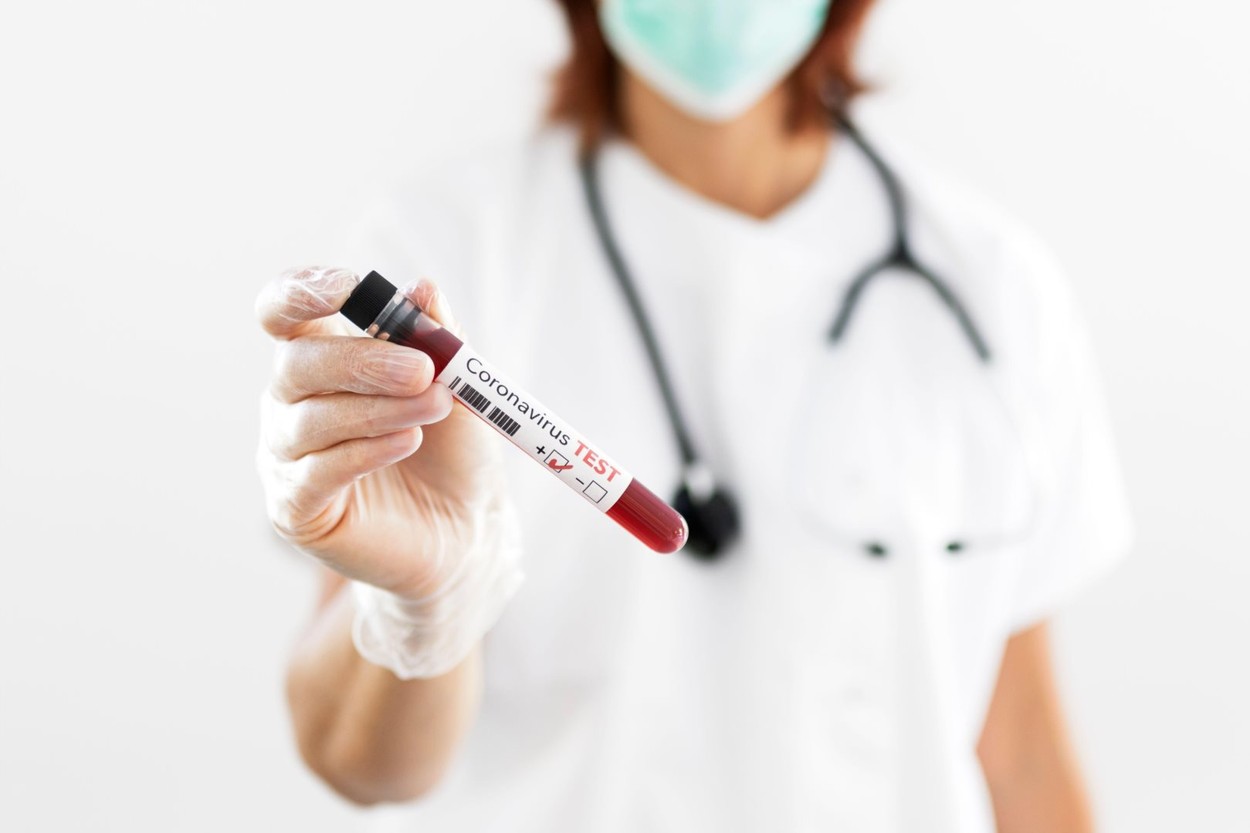 LIVE UPDATE 20 iunie: Numărul cazurilor noi se menține peste pragul de 300. Bilanțul deceselor a urcat la 1500