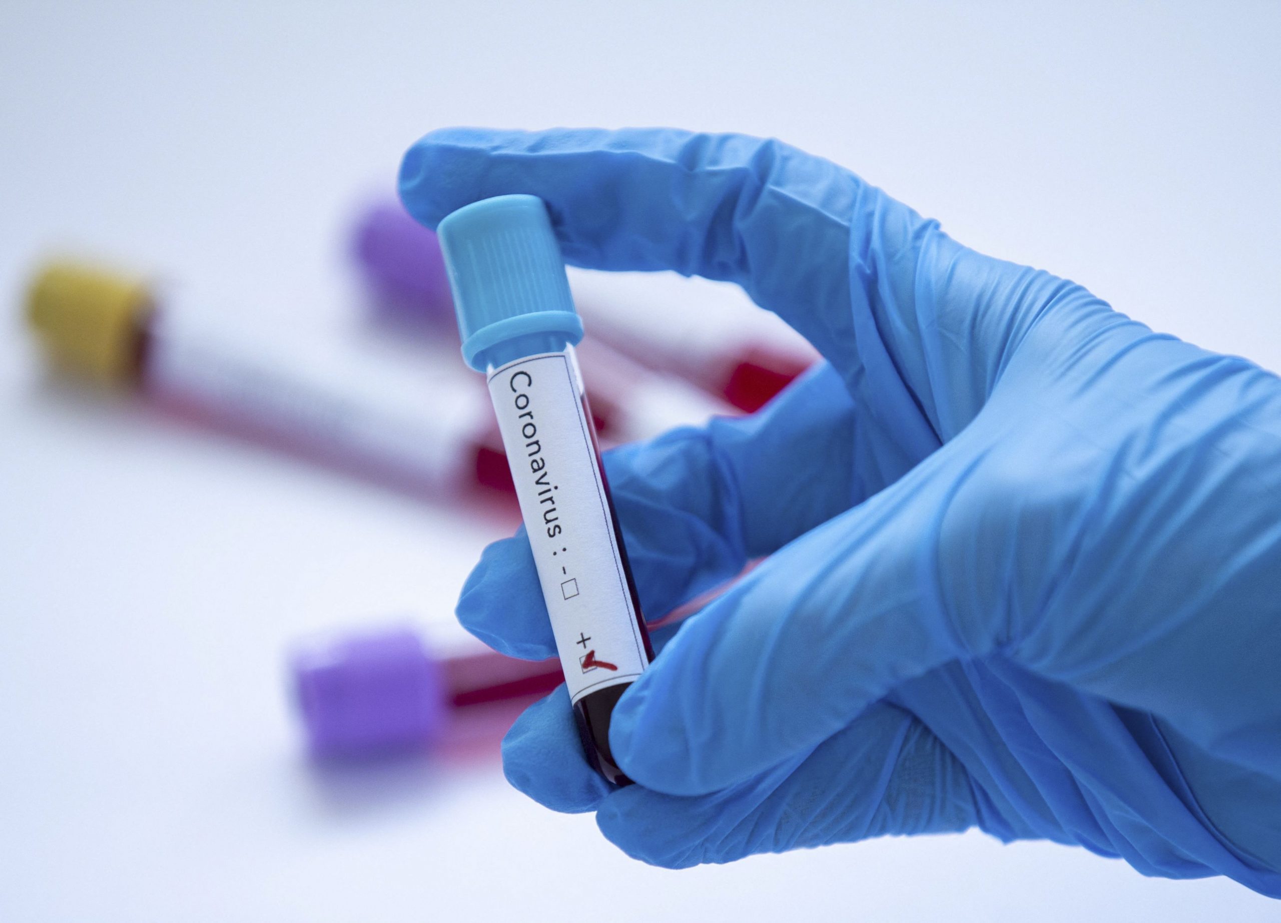 Focar de infecție cu COVID-19 la Șantierul Naval Damen Galați. Ce măsuri a luat conducerea companiei