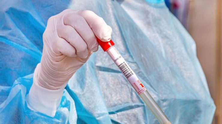 Cazurile de infectări cu COVID-19 din România au crescut. „Această evoluție negativă reclamă un efort sporit de conformare la conduita sanitară”