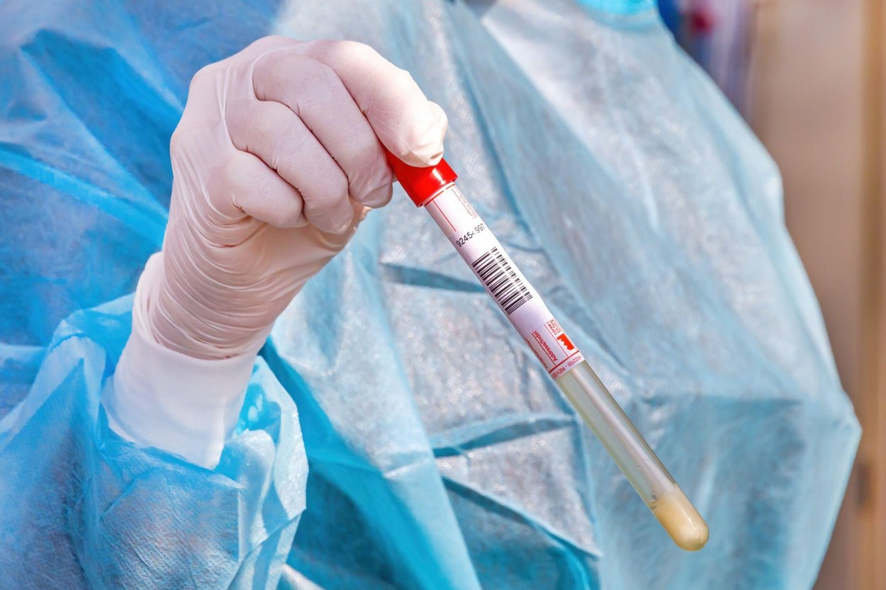 Cazurile de infectări cu COVID-19 din România au crescut. „Această evoluție negativă reclamă un efort sporit de conformare la conduita sanitară”