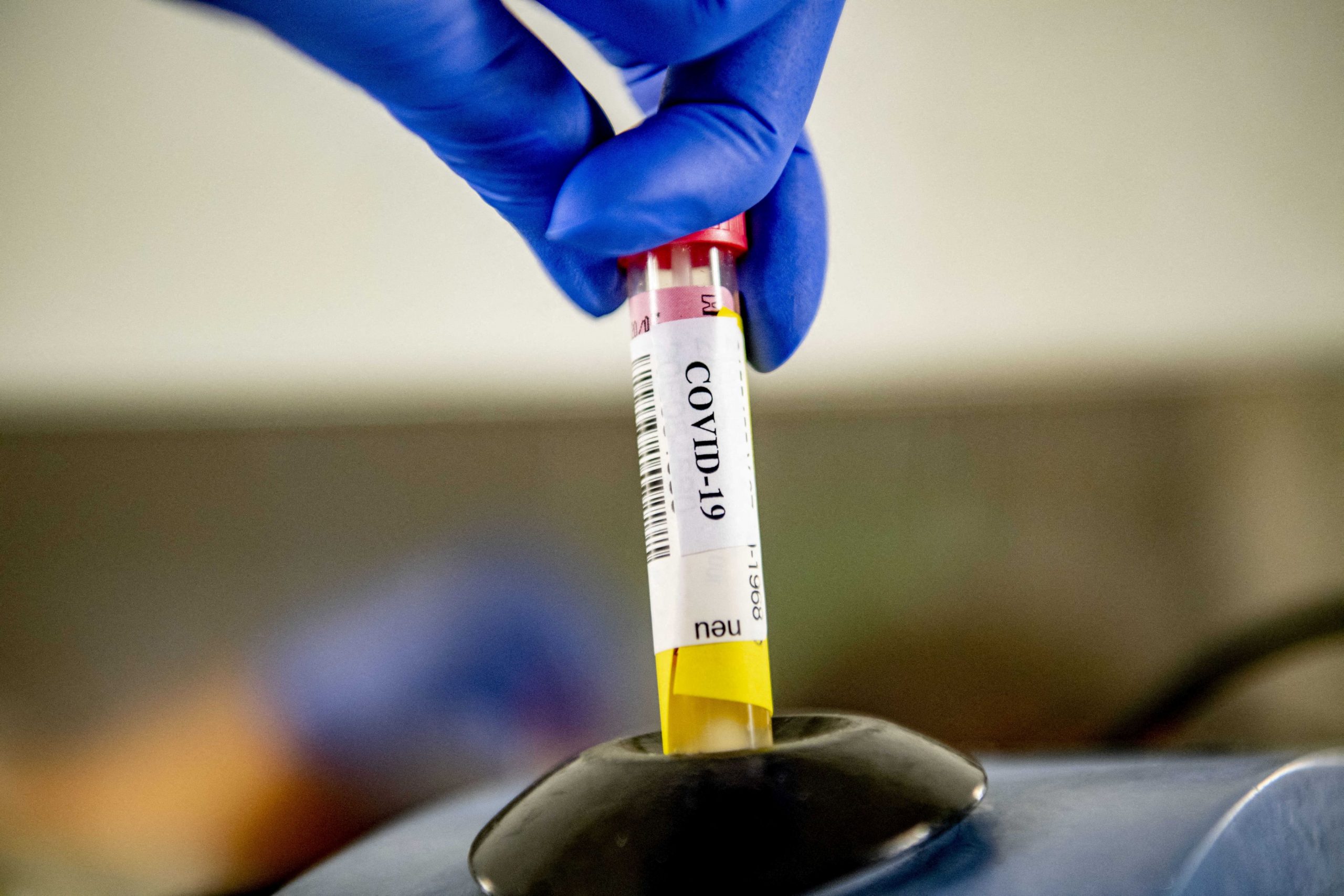 Bill Gates, despre compania sud-coreeană susținută de el:  Poate să producă 200 de milioane doze de vaccin până în iunie 2021