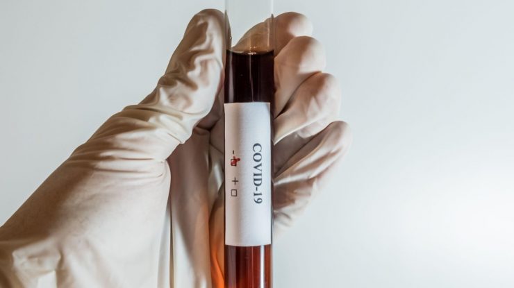 OMS: Există „șanse reale” ca un al doilea val de coronavirus să apară, pe măsură ce se redeschid economiile