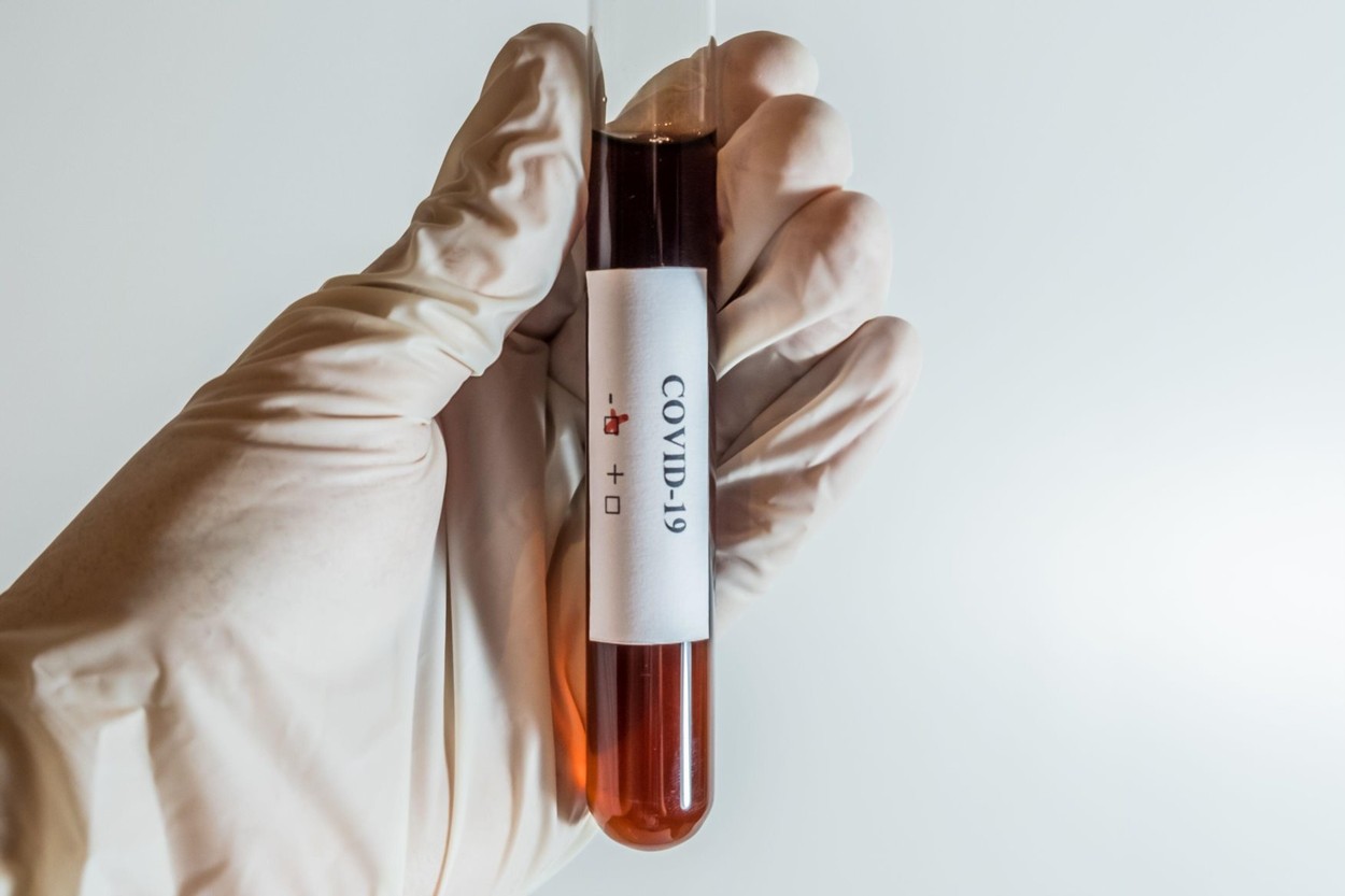 OMS: Există „șanse reale” ca un al doilea val de coronavirus să apară, pe măsură ce se redeschid economiile