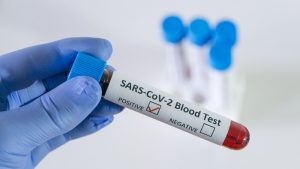 virusul SARS-COV-2