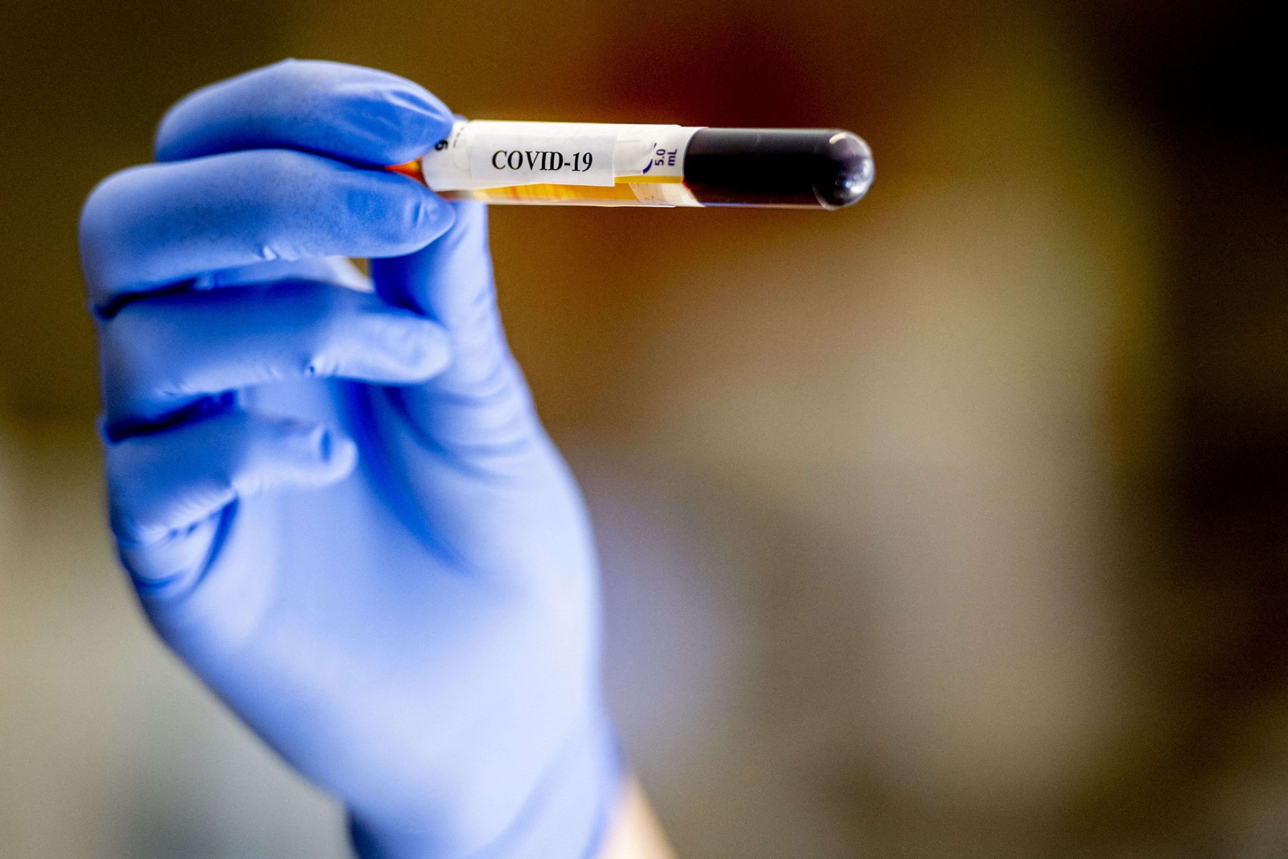 Anchetă epidemiologică la Institutul „Marius Nasta”: o asistentă din blocul operator a fost infectată cu COVID-19