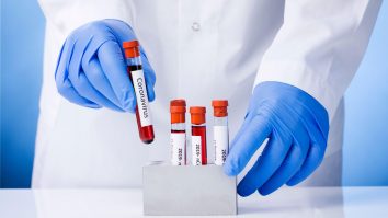 Studiu: 53% dintre pacienții COVID-19 din Germania, ventilați mecanic, au murit