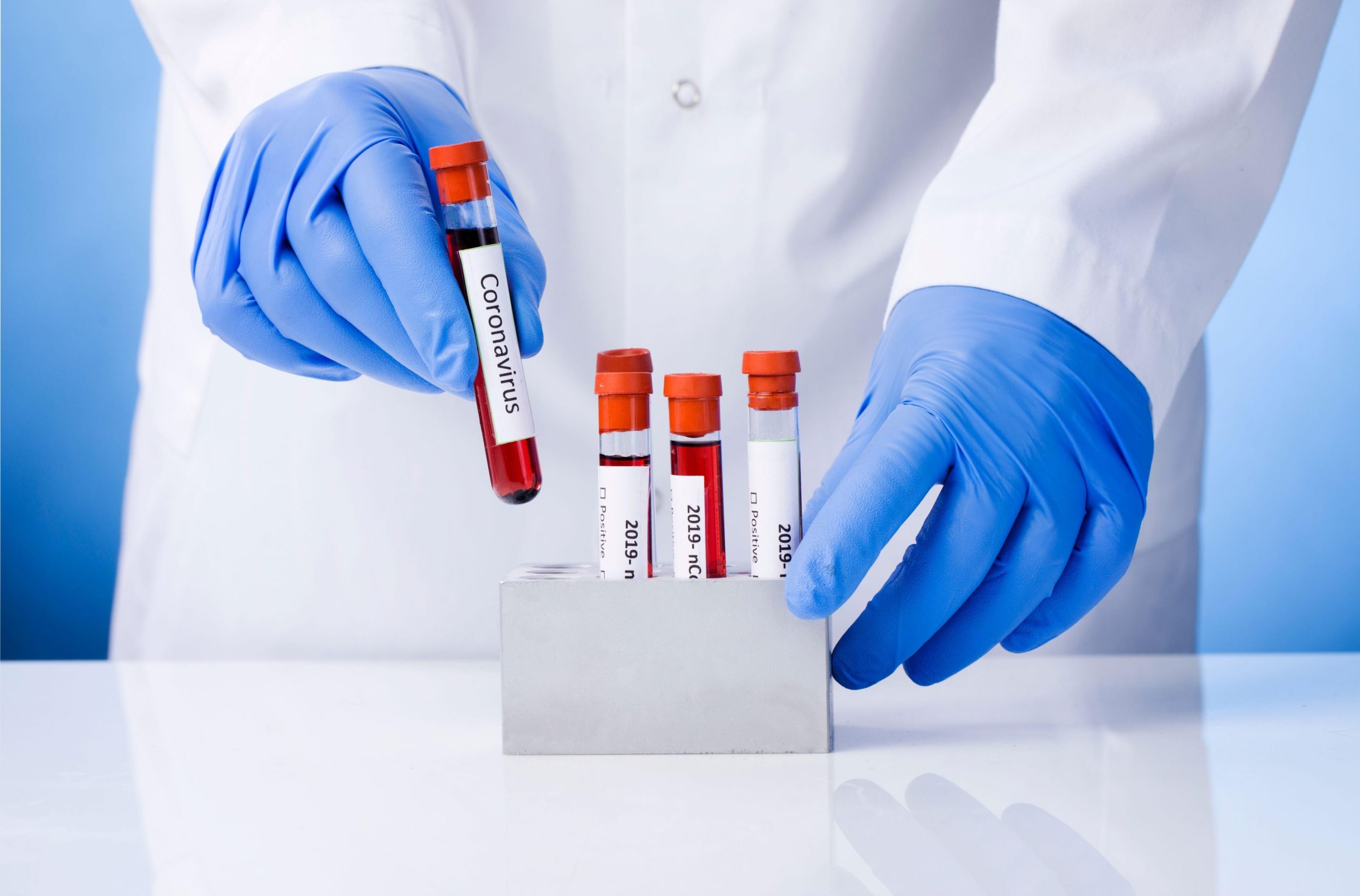 Studiu: 53% dintre pacienții COVID-19 din Germania, ventilați mecanic, au murit