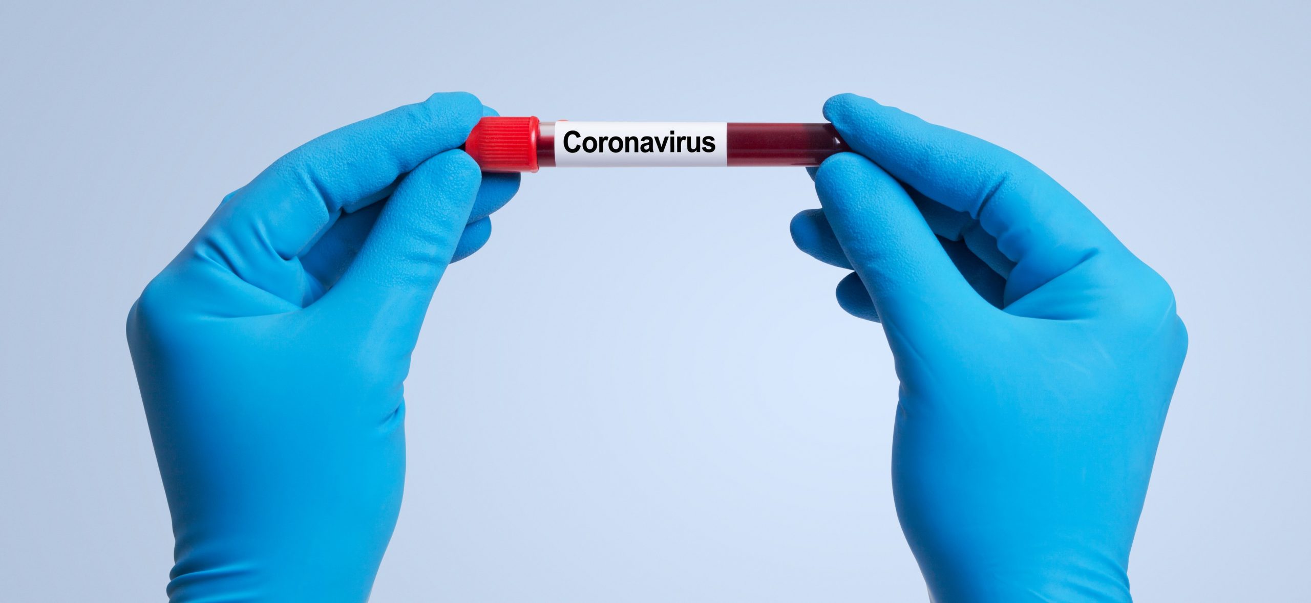 LIVE UPDATE 10 iulie: Numărul de cazuri rămâne la fel de ridicat. 592 de noi infectări raportate în ultimele 24 de ore