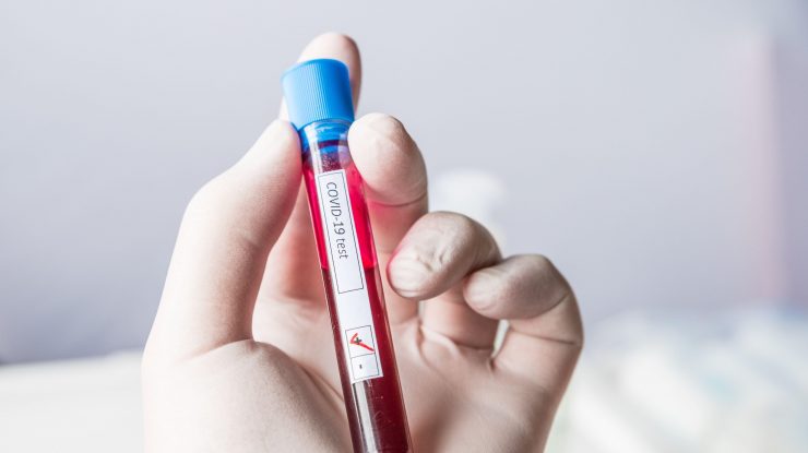 Studiu COVID-19: Britanicii au descoperit 6 forme ale bolii și simptomele aferente