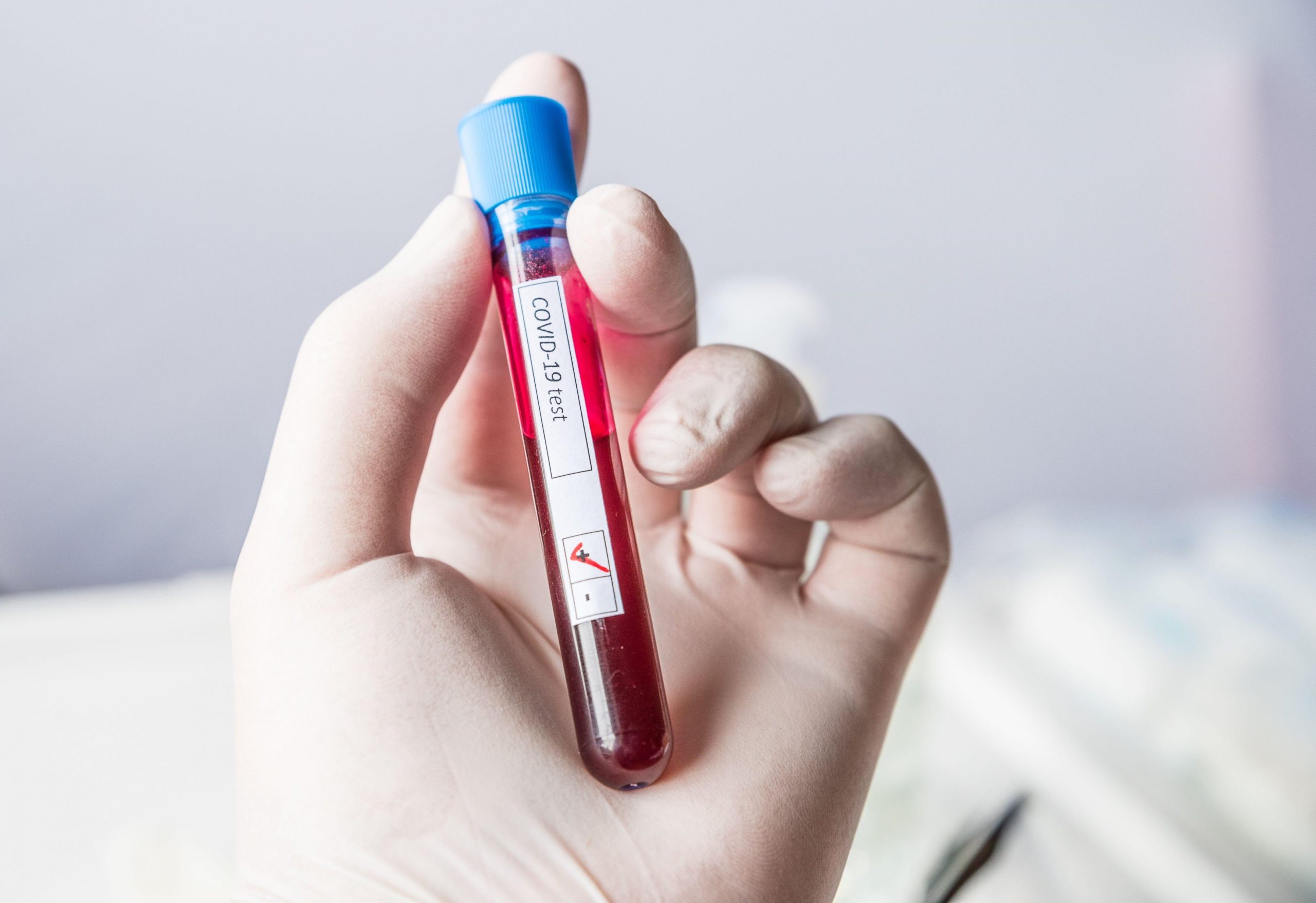 Un medic vindecat de Covid-19 este testat din nou pozitiv la fiecare trei zile și spune că nu mai are încredere în testele RT-PCR