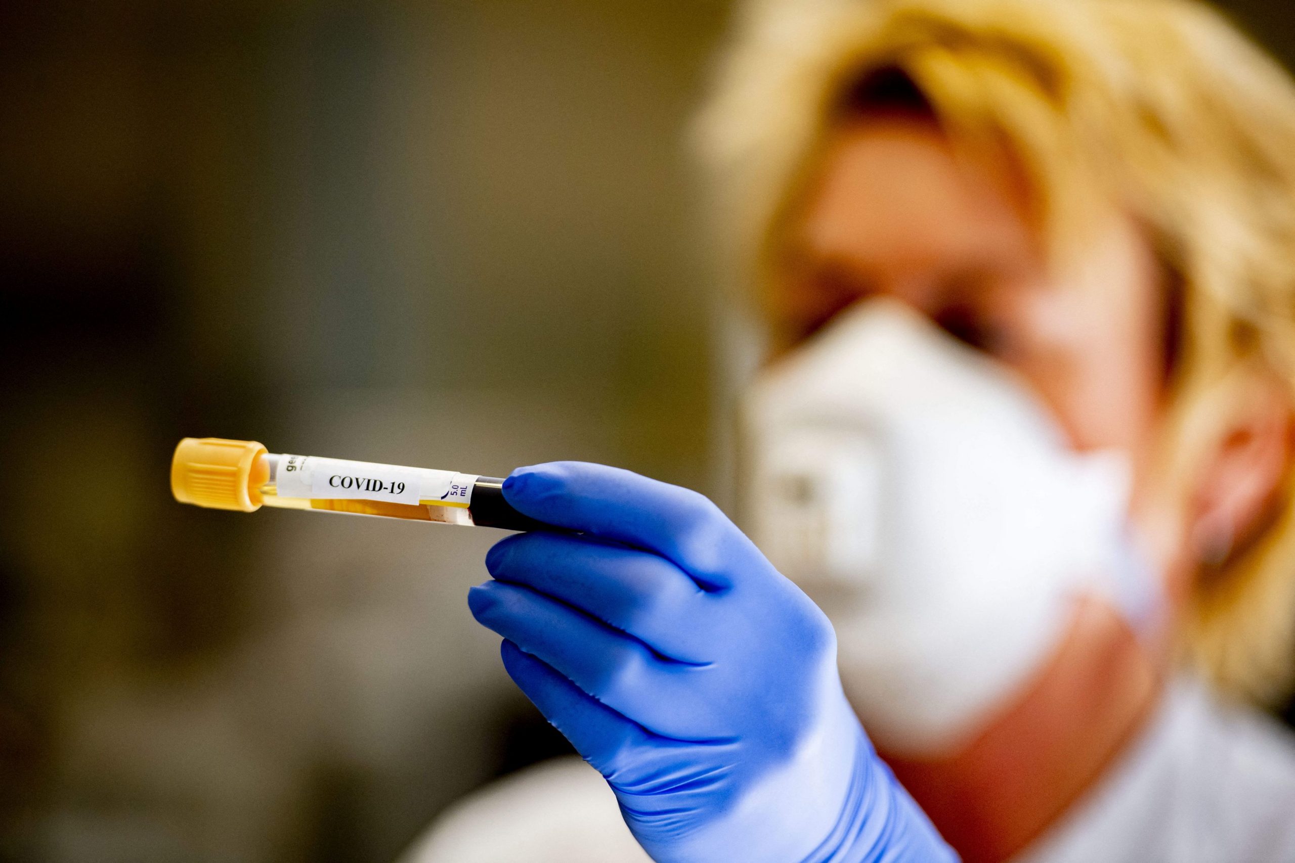 Focar de COVID-19 la un hotel din Australia: angajații au făcut sex cu persoanele carantinate