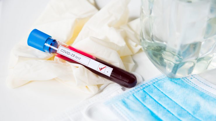 Studiu britanic: Imunitatea la Covid-19 ar putea dura doar câteva luni