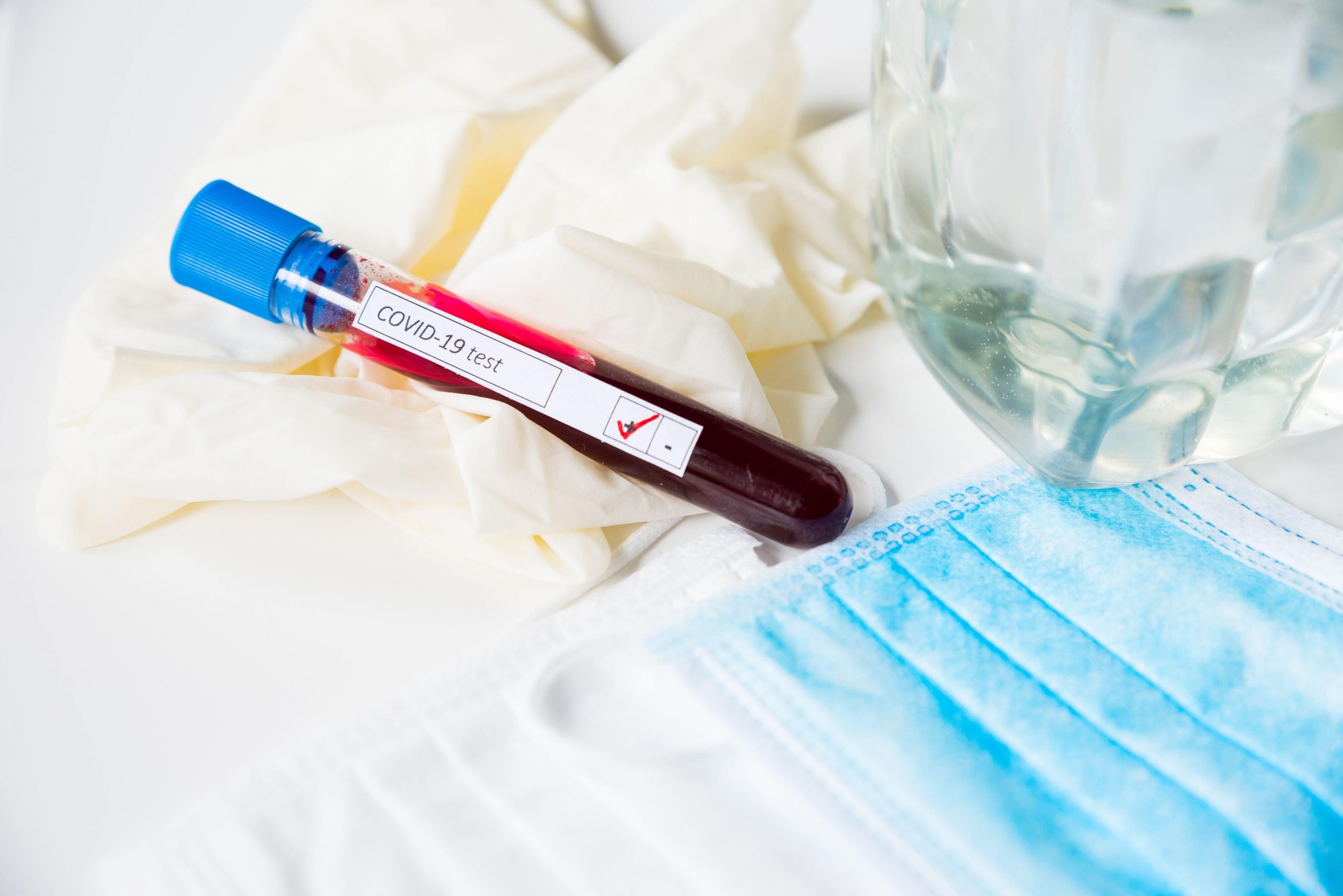 Studiu britanic: Imunitatea la Covid-19 ar putea dura doar câteva luni