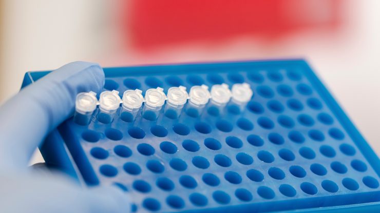 OMS prezintă o altă variantă despre primele cazuri de COVID-19 din Wuhan