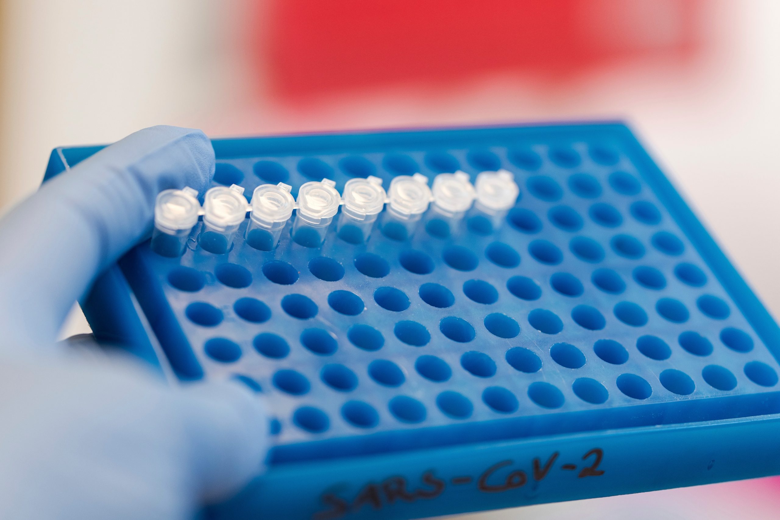 OMS prezintă o altă variantă despre primele cazuri de COVID-19 din Wuhan