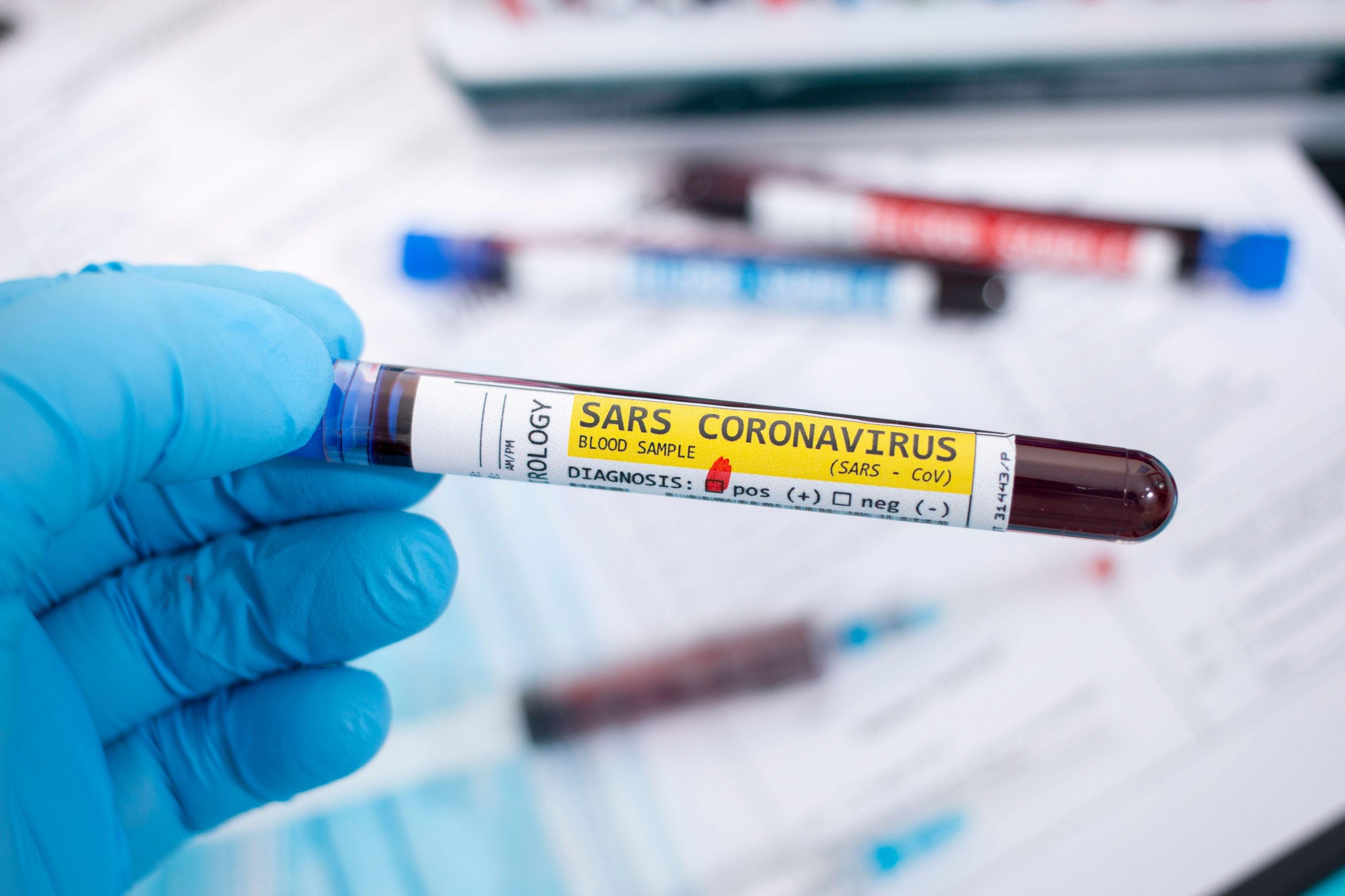 ONU avertizează: Va crește  numărul de boli transmise de la animal la om. Ce arată raportul despre zoonoză