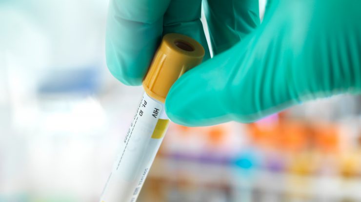 Motivul pentru care bulgarii au ocazia să se testeze anti HIV, însă refuză să o facă