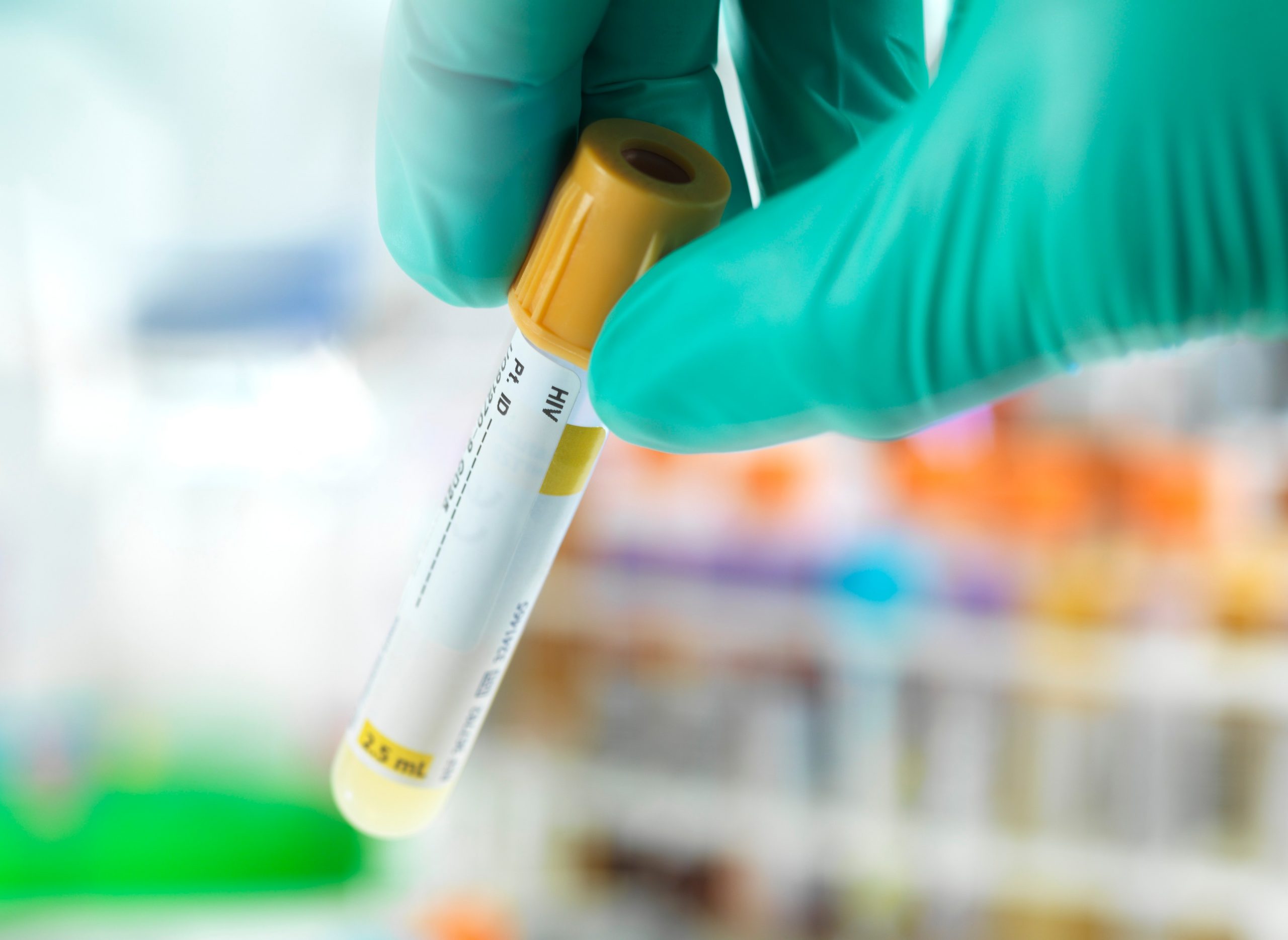 Motivul pentru care bulgarii au ocazia să se testeze anti HIV, însă refuză să o facă