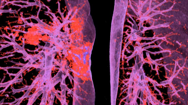 De ce unii oameni care nu au avut Covid-19 ar putea avea deja imunitate