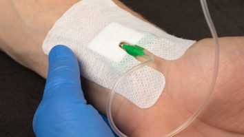 Cercetătorii spun că un test de sânge ar putea depista cancerul cu câțiva ani înainte ca simptomele să apară