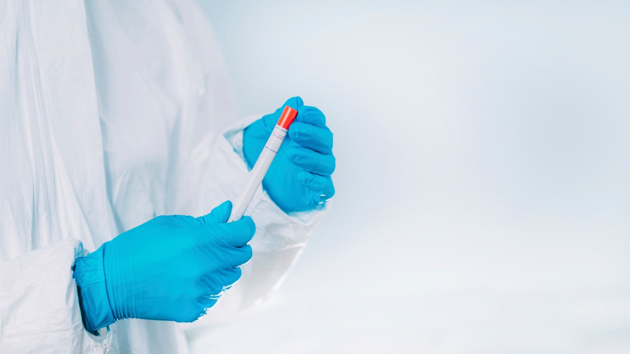 Țara care începe producţia unui test de anticorpi cu o fiabilitate de 98%