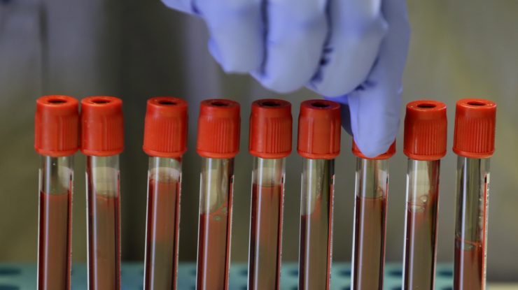 Vino să donezi. Stocurile de sânge din Iaşi sunt inexistente, iar operaţiile sunt amânate