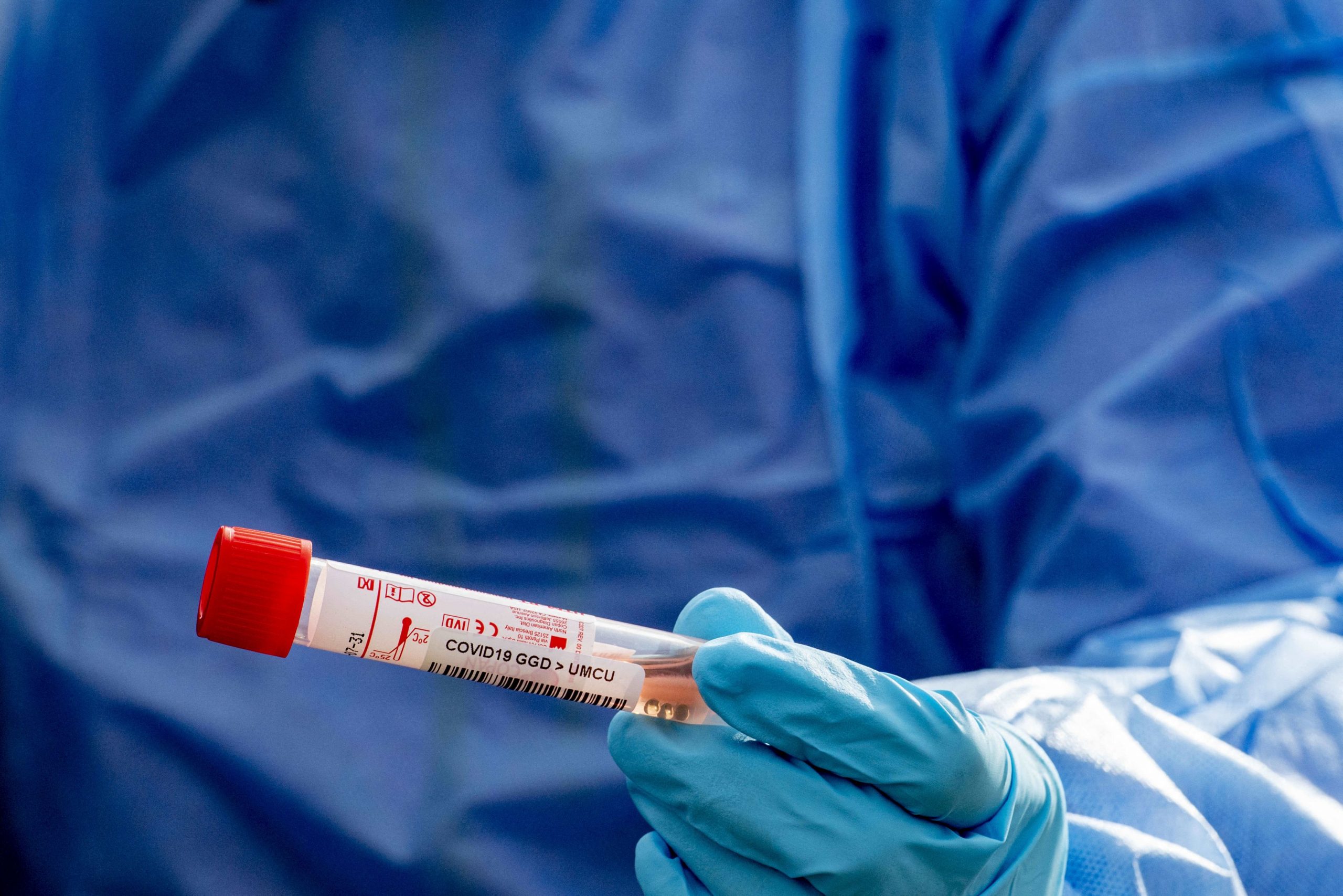 Peste 260 de români, care lucrează la o fabrică de conserve din Germania, sunt infectați cu COVID-19