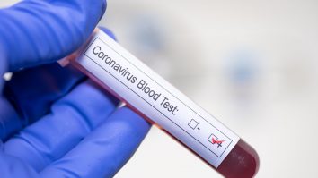 Persoanele de culoare ar putea fi mai afectate de COVID-19 decât albii