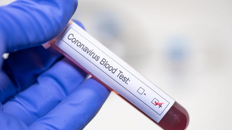 Coronavirus în România LIVE UPDATE 12 octombrie. 2.069 cazuri noi și 628 de bolnavi la ATI