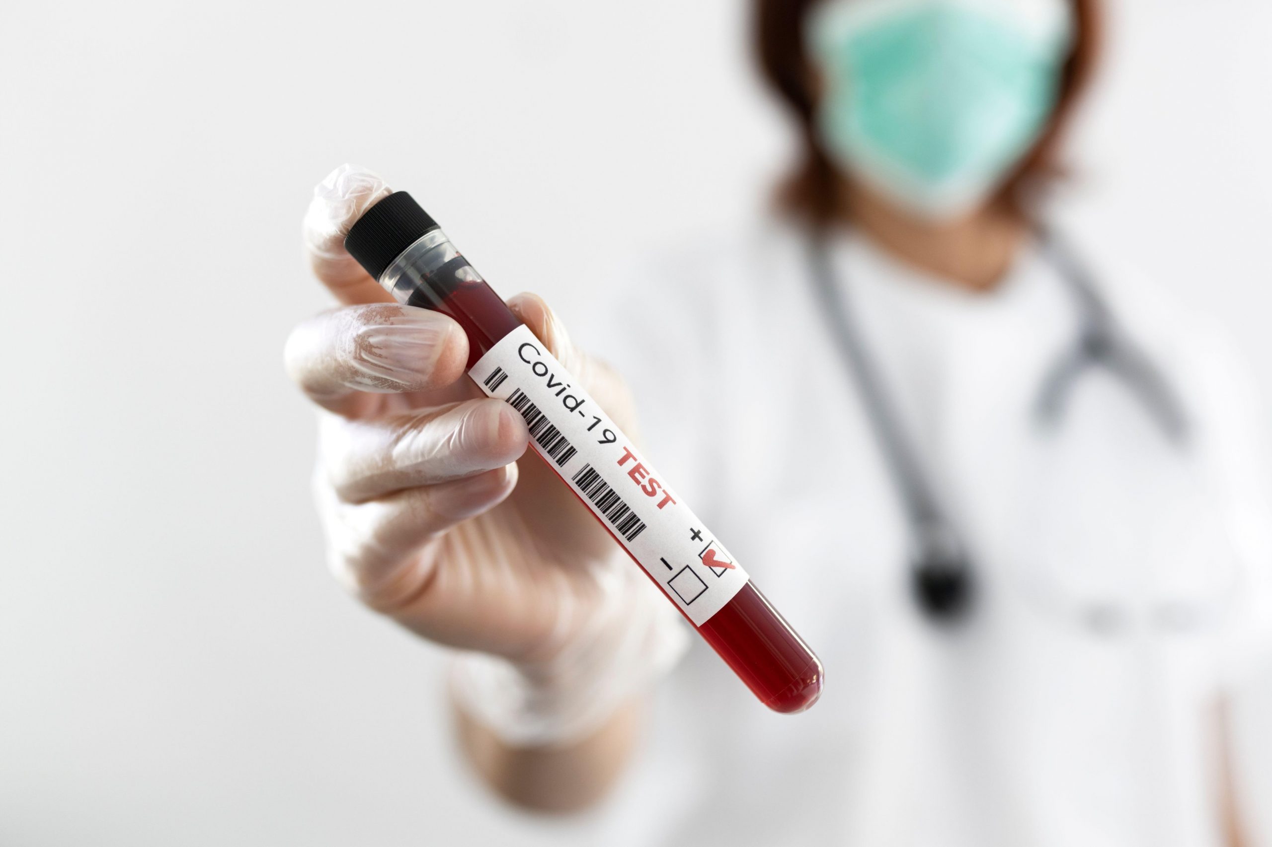 Cercetătorii au raportat două cazuri noi de reinfectare cu COVID-19 în Europa