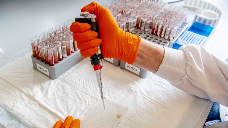 Coronavirus în lume LIVE UPDATE 2 august: Stare de calamitate naturală în Victoria, Australia / Peste 18 milioane de cazuri de COVID-19 în lume