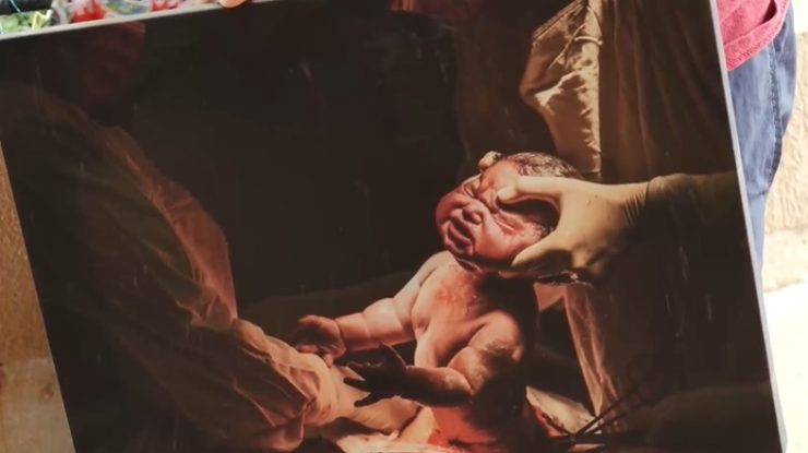 Fotograful care surprinde momentul emoționant în care o mamă își vede prima oară bebelușul