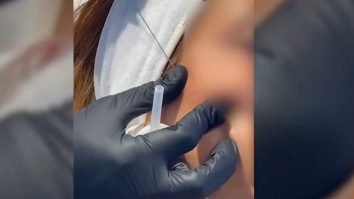 Fir întins la frumusețe. Tu știi ultimul trend în materie de lifting facial?