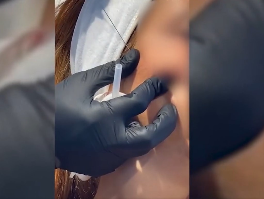 Fir întins la frumusețe. Tu știi ultimul trend în materie de lifting facial?