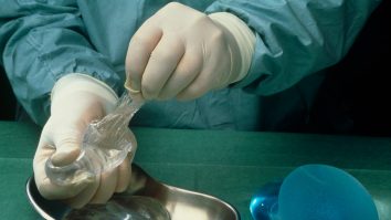 Ce trebuie să știi despre implanturile mamare. Ioana s-a operat la sâni săptămâna trecută